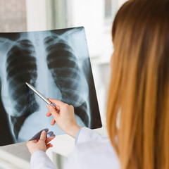 Влияние вейпинга на флюорографию: что показывает снимок легких