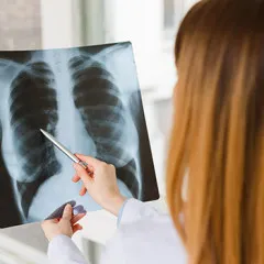 Влияние вейпинга на флюорографию: что показывает снимок легких